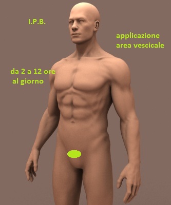  ipertrofia prostatica dieta gratis