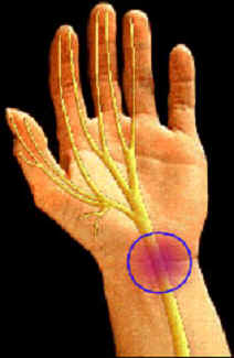 magnetoterapia dolori muscolari